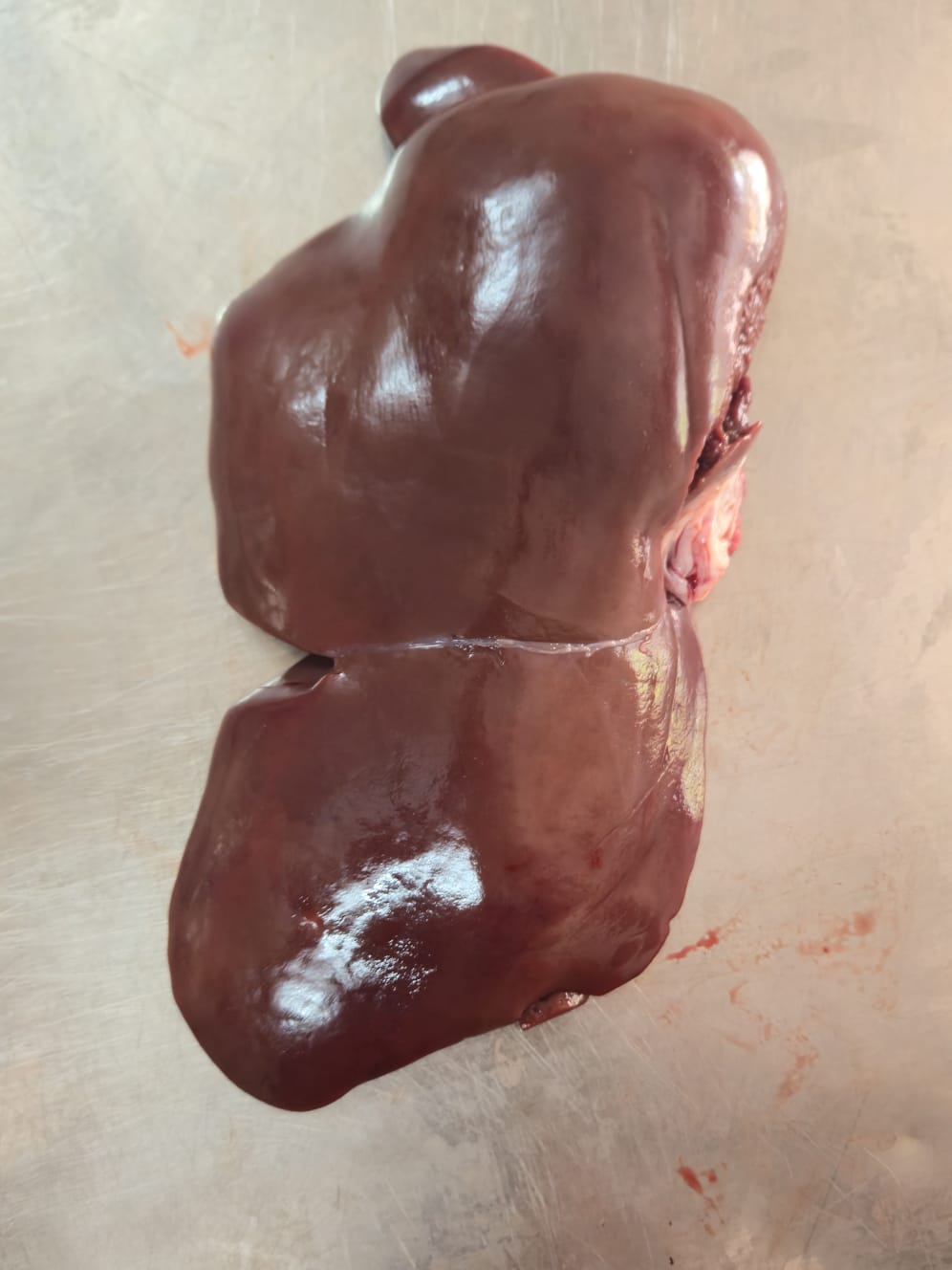Liver